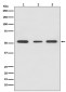 Anti-PPAR gamma Rabbit Monoclonal Antibody